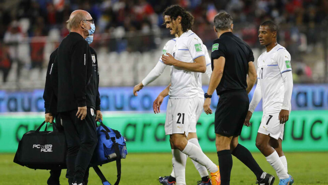Кавани получил травму во время матча сборной Уругвая